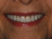 Konig Center for Cosmetic & Comprehensive Dentistry smile photos